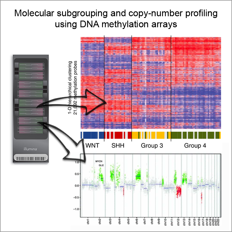 Robust molecular subgrouping and copy-number profiling of medulloblastoma from small amounts of archival tumour material using high-density DNA methylation arrays