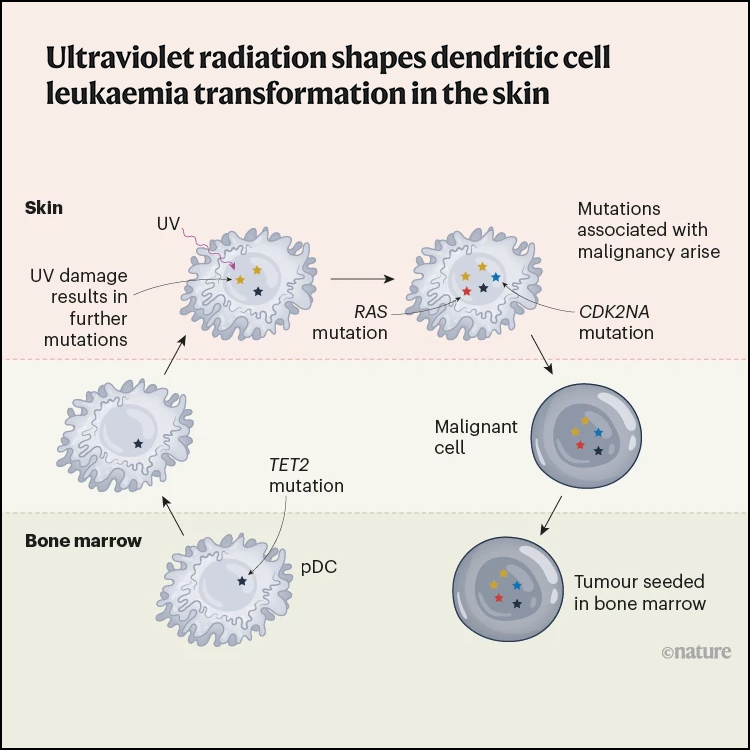 Ultraviolet radiation shapes dendritic cell leukaemia transformation in the skin