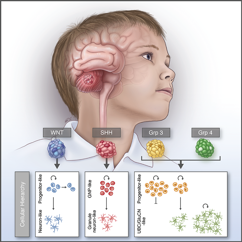 Resolving medulloblastoma cellular architecture by single-cell genomics