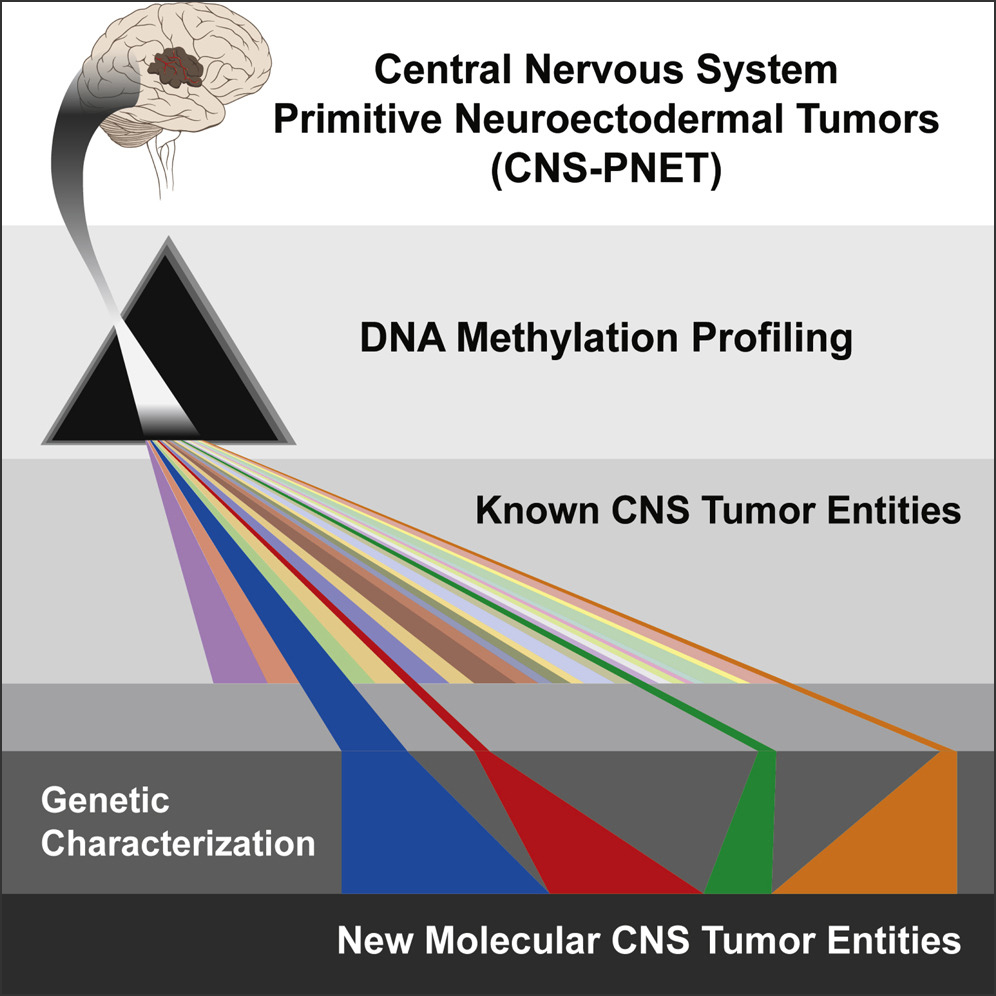 New Brain Tumor Entities Emerge from Molecular Classification of CNS-PNETs