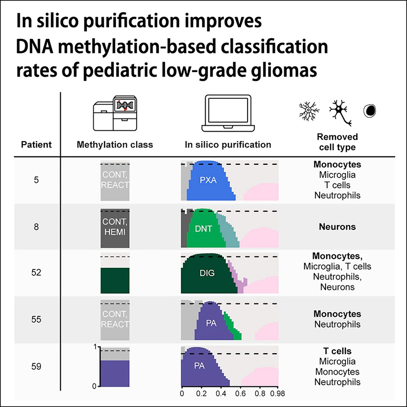 In silico purification improves DNA methylation-based classification rates of pediatric low-grade gliomas