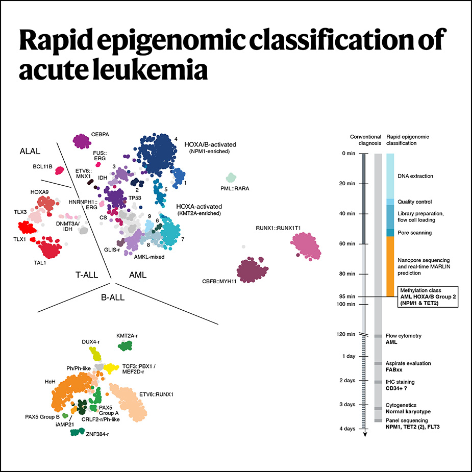 Rapid epigenomic classification of acute leukemia