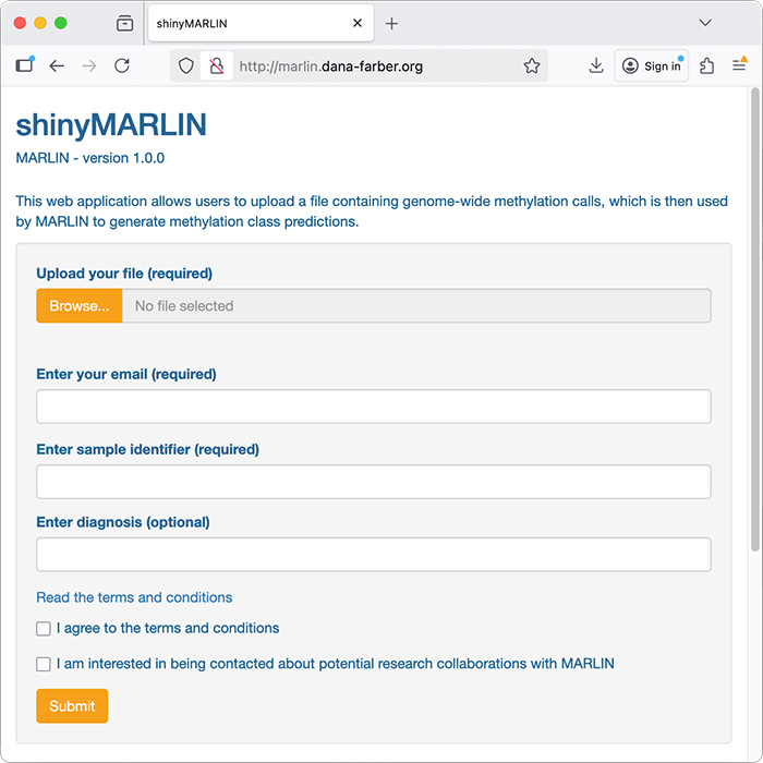 Nanopore-based classification of acute leukemia